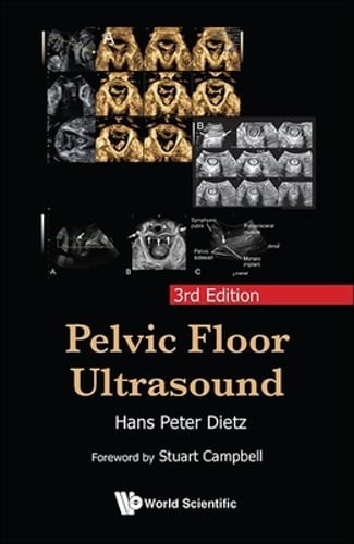 Pelvic Floor Ultrasound (3rd Edition) by Hans Peter Dietz: New